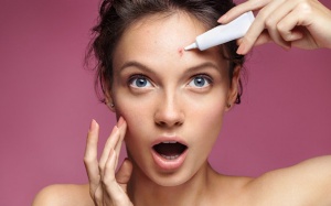 Biện pháp xử lý mụn trên trán hiệu quả 