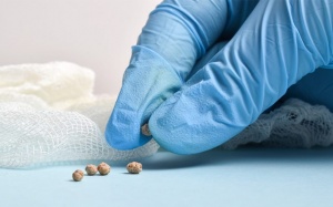 Sỏi mật 3mm có nguy hiểm không?