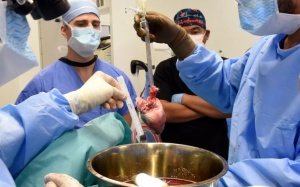 Bệnh nhân thứ 2 trên thế giới được cấy ghép tim lợn