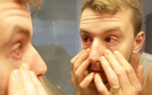 Triệu chứng ở mắt 'tố' tình trạng sức khỏe của bạn