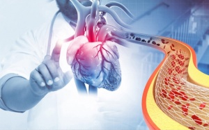 Mắc bệnh mạch vành nhưng không đặt được stent, sức khỏe yếu phải làm gì?