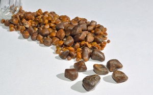 Sỏi mật 20mm có nguy hiểm không, nên điều trị thế nào?