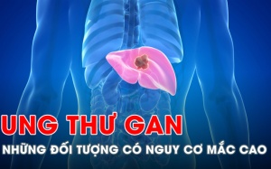 Ai có nguy cơ cao mắc ung thư gan?