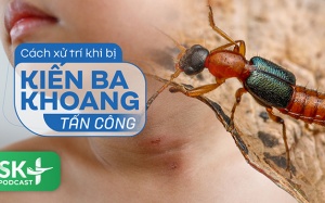 Podcast: Cách xử trí khi bị kiến ba khoang tấn công