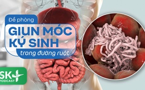 Podcast: Đề phòng giun móc ký sinh trong đường ruột