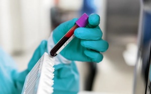 Tầm soát ung thư & lời khuyên của bác sỹ Lân Hiếu