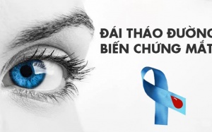 Người bệnh cần biết gì về đái tháo đường biến chứng qua mắt?