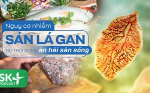 Podcast: Nguy cơ nhiễm sán lá gan do thói quen ăn hải sản sống