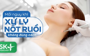 Podcast: Mối nguy khi xử lý nốt ruồi không đúng cách