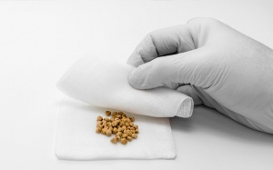 Sỏi túi mật 5mm, uống thuốc Tây không đỡ có nên mổ không?