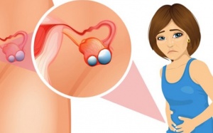 Dấu hiệu u nang buồng trứng và cách cải thiện hiệu quả từ thảo dược