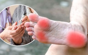 Tê bì, châm chích chân tay: Cẩn thận biến chứng đái tháo đường!