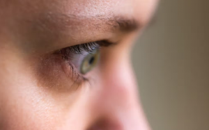 Bệnh Basedow có thể gây biến chứng lồi mắt