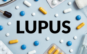 Làm sao để sống khỏe mạnh với bệnh lupus ban đỏ?