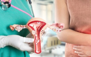 4 dấu hiệu cảnh báo sớm bệnh ung thư cổ tử cung