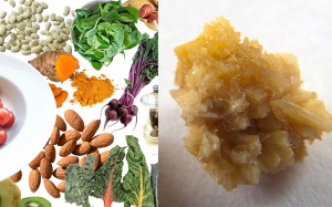 Khi nào cần thực hiện chế độ ăn ít oxalate?