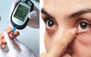 Đường huyết 13,8mmol/L kèm mờ mắt, tiểu đêm: Làm sao để cải thiện?