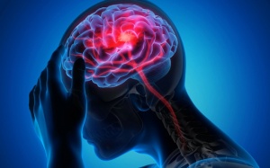 Thực trạng bệnh lý đột quỵ não trên toàn thế giới