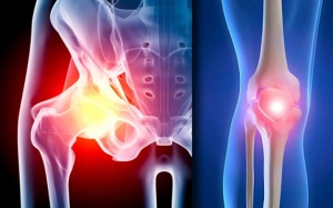 Y tế tuần: Kỹ thuật thay khớp giúp người bệnh thoát khỏi nguy cơ tàn phế