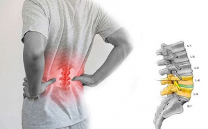 Bệnh gai đốt sống lưng: Nguyên nhân và cách cải thiện