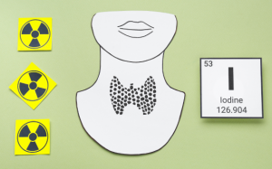 3 phương pháp điều trị bệnh Basedow phổ biến hiện nay