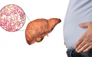 Kiểm soát cân nặng: Thói quen tốt giúp bảo vệ gan