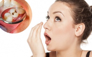Mách bạn cách trị hôi miệng do sâu răng 