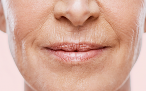 Nguyên nhân chính khiến môi nhiều nếp nhăn
