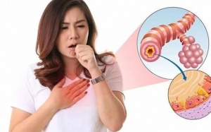 Kiểm soát bệnh viêm phế quản mạn tính thế nào?
