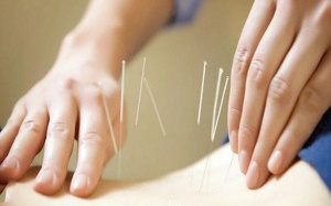 Điều trị thoát vị đĩa đệm bằng y học cổ truyền như thế nào?