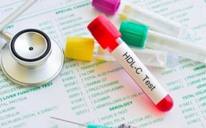 Biện pháp duy trì chỉ số “cholesterol tốt” HDL tối ưu