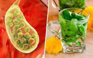 Cách đẩy sỏi mật ra ngoài từ mẹo dân gian liệu có hiệu quả?