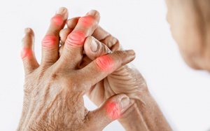 Bệnh gout và những biến chứng cần đề phòng