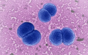 CDC Mỹ cảnh báo về vi khuẩn gây bệnh viêm não mô cầu hiếm gặp