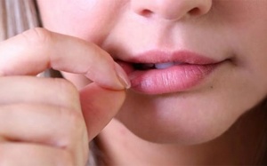 Cẩn trọng với thói quen bóc da môi 
