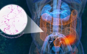 Phát hiện loại vi khuẩn trong miệng là 'thủ phạm' gây ung thư đại trực tràng