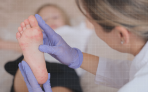 Các phương pháp điều trị bệnh tay chân miệng hiện nay