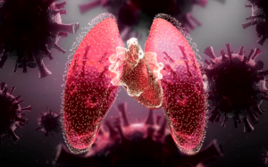 Ung thư phổi giai đoạn 3 sống được bao lâu?