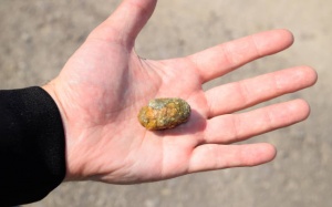 Sỏi mật 30mm dùng TPBVSK Kim Đởm Khang được không?