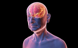 Đột phá: Xét nghiệm máu giúp dự đoán trước nguy cơ đột quỵ