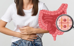 Ung thư đại trực tràng đang gia tăng ở trẻ em và thanh thiếu niên