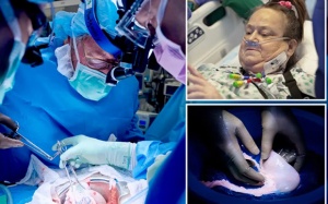 Người thứ 2 trên thế giới ghép thận lợn phải chạy thận trở lại