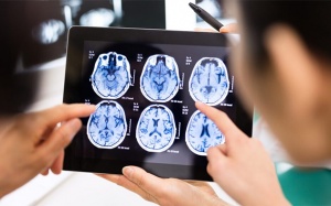 Chuyên gia giải đáp: Thoái hóa chất trắng nguy hiểm không?