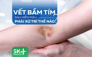 Podcast: Vết bầm tím sau lấy máu phải xử trí thế nào?