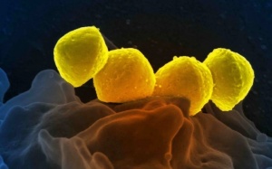 Nhật Bản: Tăng đột biến số ca sốc nhiễm độc do vi khuẩn hiếm gặp