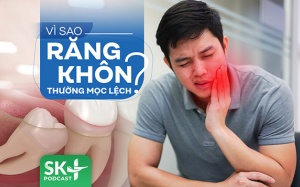 Podcast: Răng khôn mọc lệch phải làm sao?