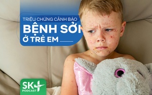 Podcast: Triệu chứng cảnh báo bệnh sởi ở trẻ em