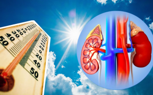 Biến đổi khí hậu có liên quan thế nào đến nguy cơ suy thận?  