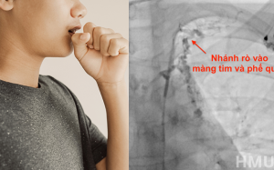 Thanh niên mắc viêm phế quản “nhựa” hiếm gặp