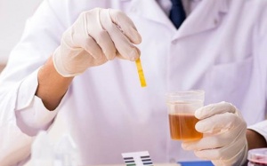 Xét nghiệm nước tiểu giúp phát hiện sớm ung thư cổ tử cung